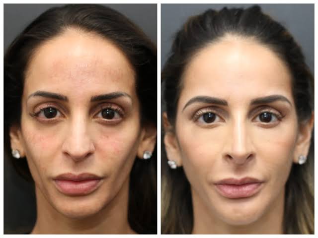 Balancing Dermal Health and Smart Aesthetic Decisions